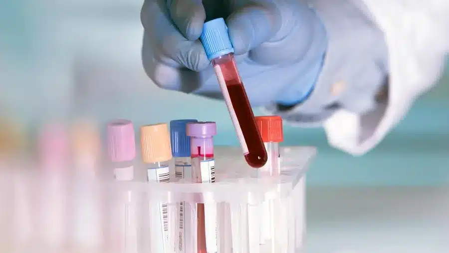 Blood Test - Drug Testing Methods for Heroin