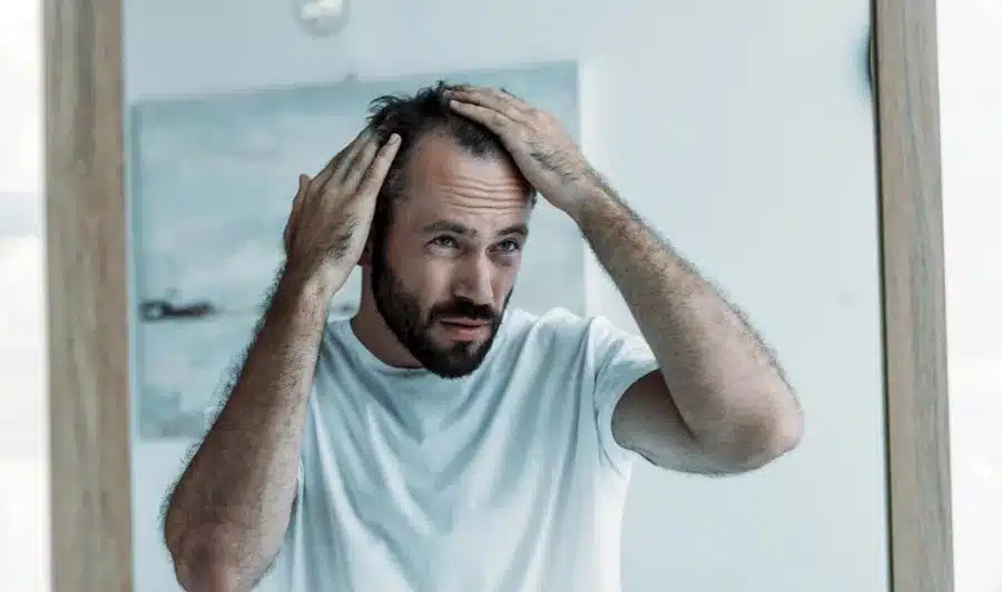 Lack of Nutrition Leads to Hair Loss